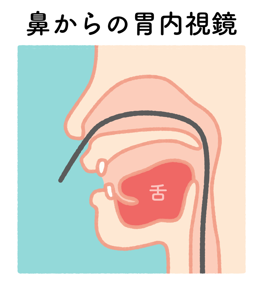 経鼻内視鏡