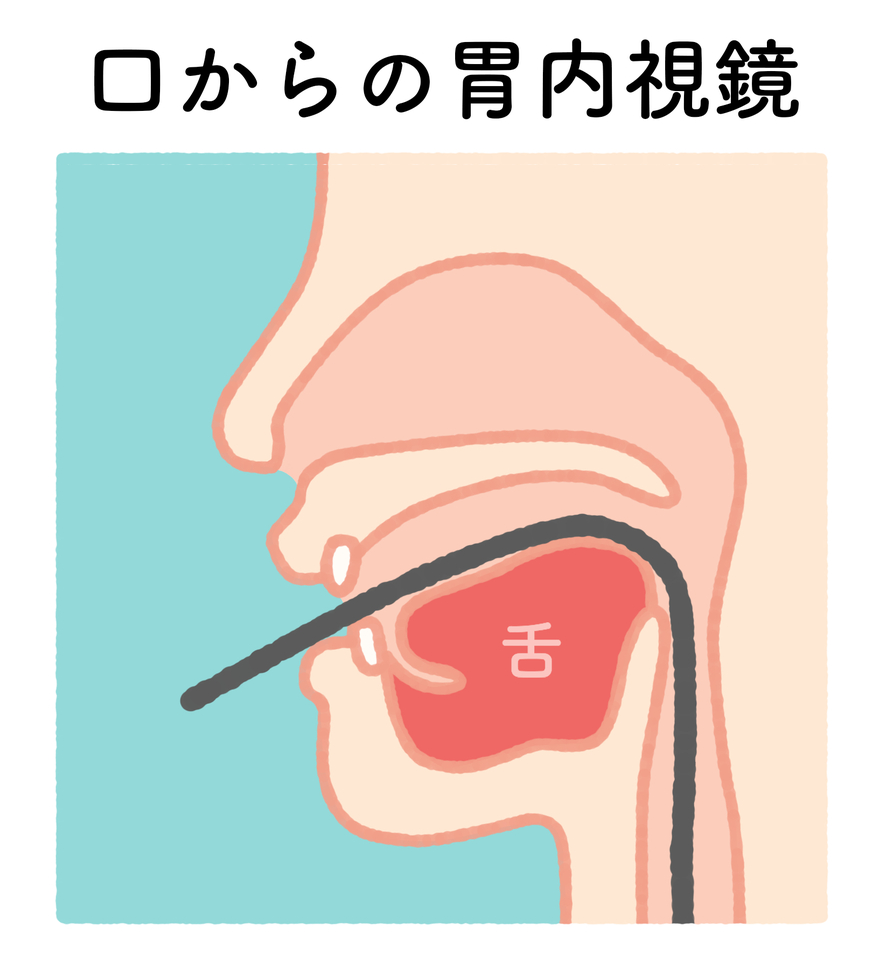 経口内視鏡