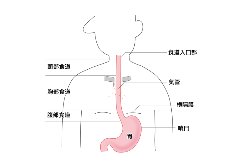 食道がんについて医師が解説